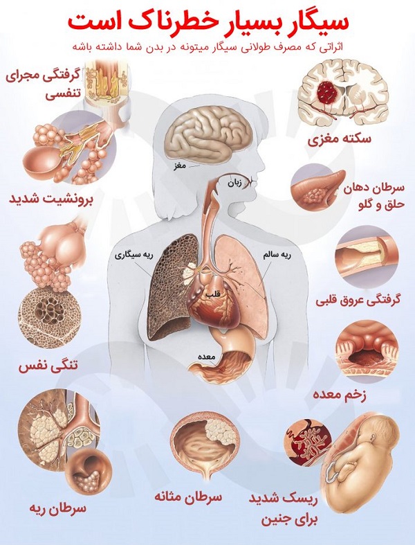 رشته کامپیوتر حسابداری معماری انیمیشن (پویا نمایی) گرافیک